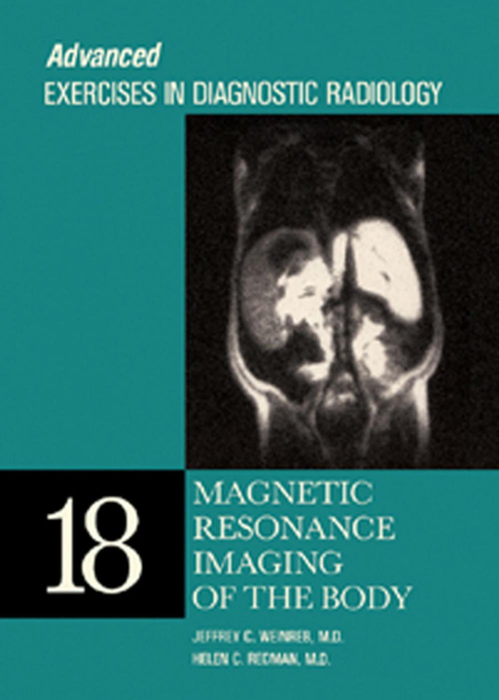 Big bigCover of Magnetic Resonance Imaging of the Body