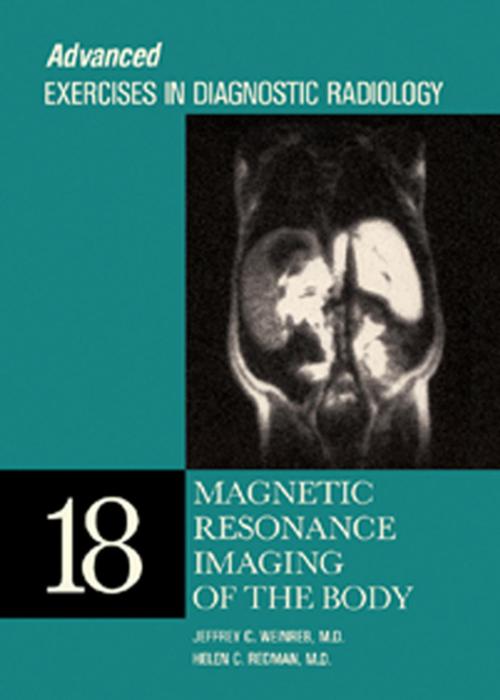 Cover of the book Magnetic Resonance Imaging of the Body by Jeffrey C. Weinreb, Helen C. Redman, MD, Elsevier Health Sciences