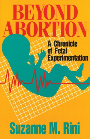 Cover of the book Beyond Abortion by D. Roberto