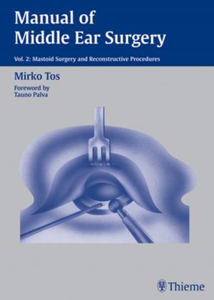 Cover of the book Manual of Middle Ear Surgery, Volume 2 by Malte Erik Wigand