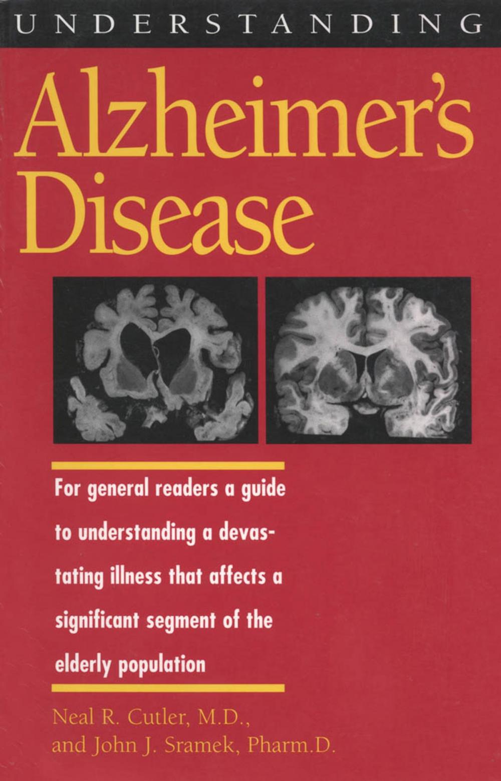Big bigCover of Understanding Alzheimer's Disease