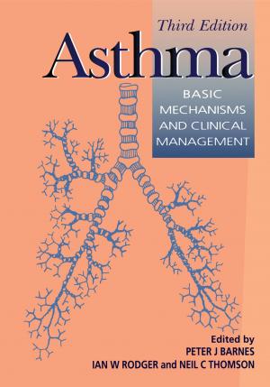 Cover of the book Asthma by Cornelius T. Leondes