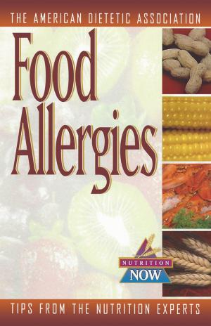 Book cover of Food Allergies