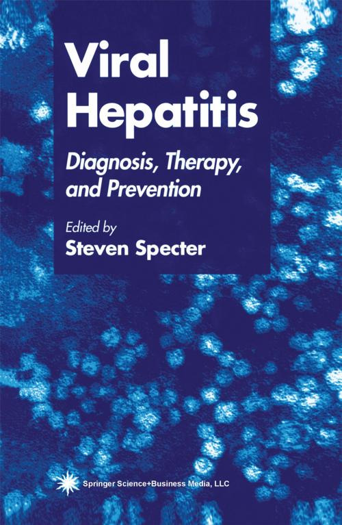 Cover of the book Viral Hepatitis by , Humana Press