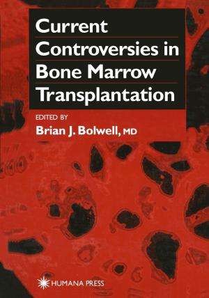 Cover of the book Current Controversies in Bone Marrow Transplantation by Christopher B. Scott