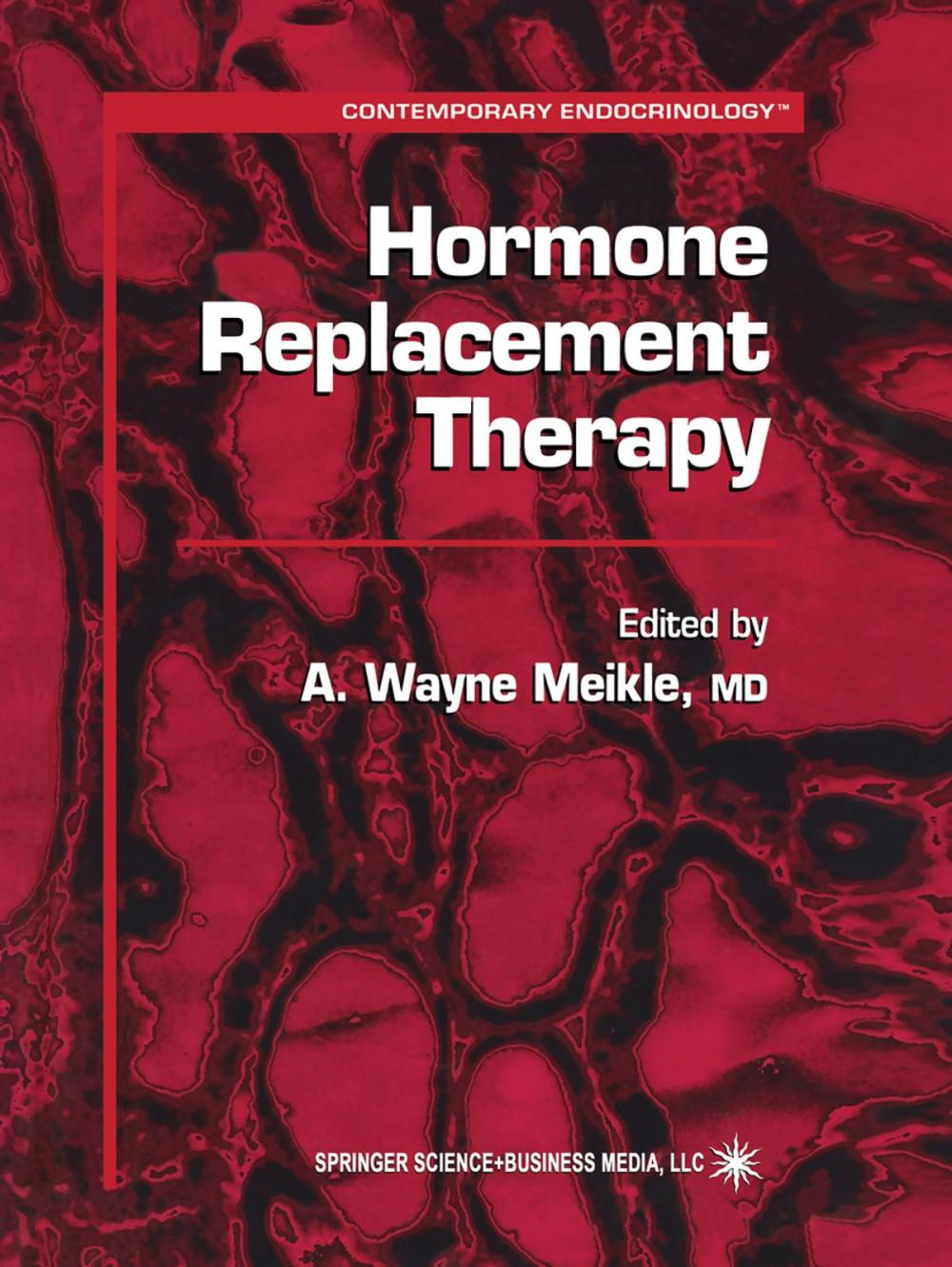 Big bigCover of Hormone Replacement Therapy