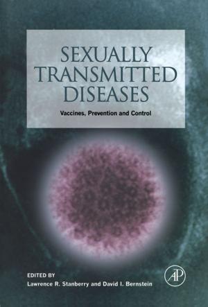 Cover of the book Sexually Transmitted Diseases by Donald DePamphilis