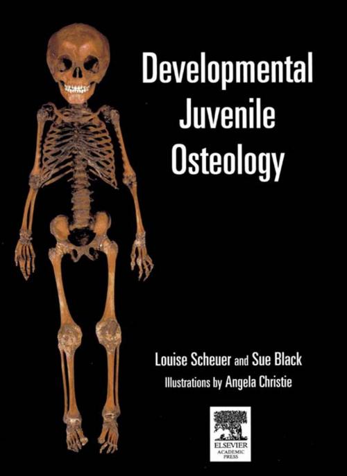 Cover of the book Developmental Juvenile Osteology by Louise Scheuer, Sue Black, Louise Scheuer, Sue Black, Craig Cunningham, Elsevier Science