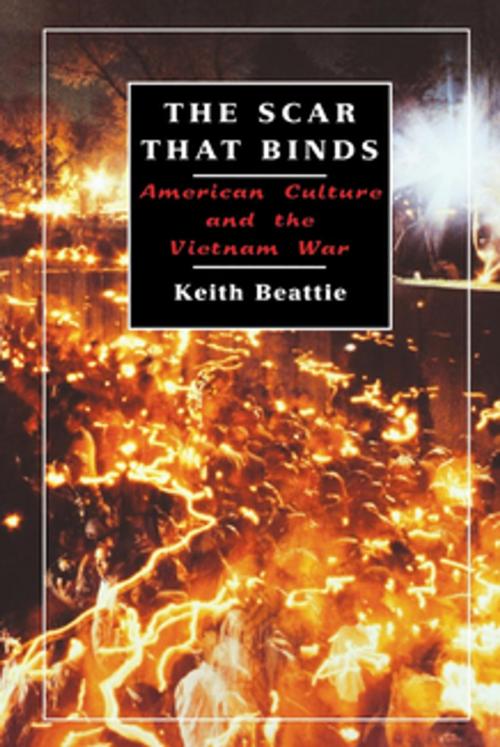 Cover of the book The Scar That Binds by Keith Beattie, NYU Press