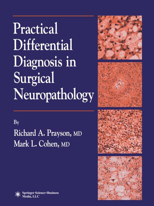 Cover of the book Practical Differential Diagnosis in Surgical Neuropathology by Mark L. Cohen, Richard A. Prayson, Humana Press
