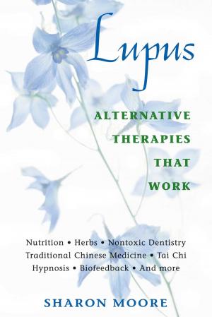Cover of the book Lupus by Nephyr Jacobsen