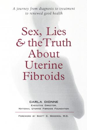 Cover of the book Sex, Lies, and the Truth about Uterine Fibroids by John A. Elefteriades, MD