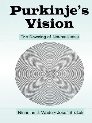 Book cover of Purkinje's Vision
