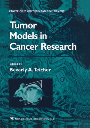 bigCover of the book Tumor Models in Cancer Research by 