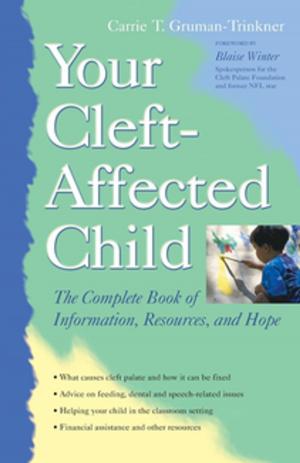 Cover of the book Your Cleft-Affected Child by Elaine Waldorf Gewirtz