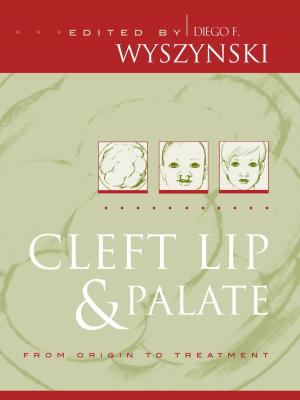 Cover of the book Cleft Lip and Palate by Deborah Tuerkheimer