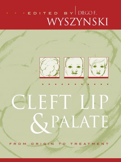 Cover of the book Cleft Lip and Palate by , Oxford University Press