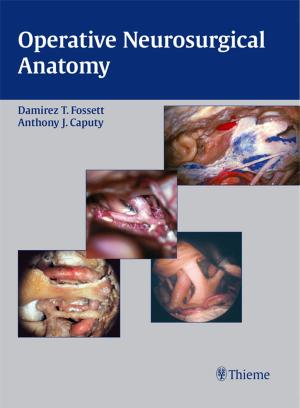 Cover of the book Operative Neurosurgical Anatomy by Rudolf Beer, Michael A. Baumann