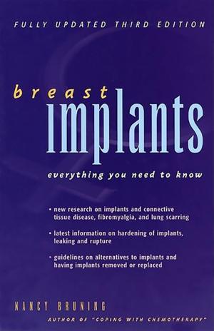 Cover of the book Breast Implants by Douglas Wilson