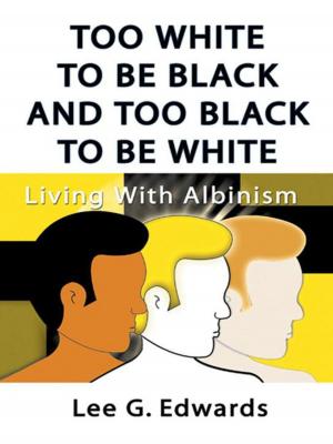 Cover of the book Too White to Be Black and Too Black to Be White: Living with Albinism by Capt. Gardner Martin Kelley
