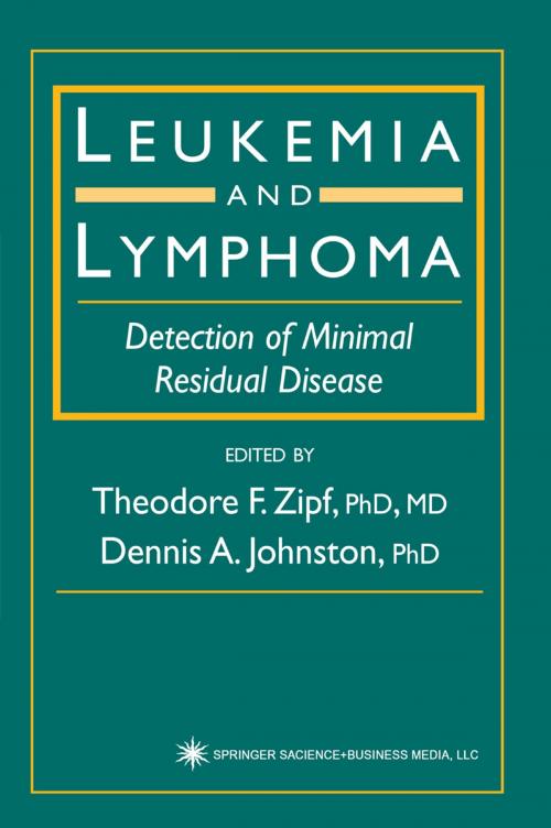 Cover of the book Leukemia and Lymphoma by , Humana Press