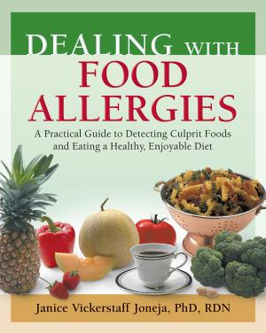 Cover of the book Dealing with Food Allergies by Ellyn Satter