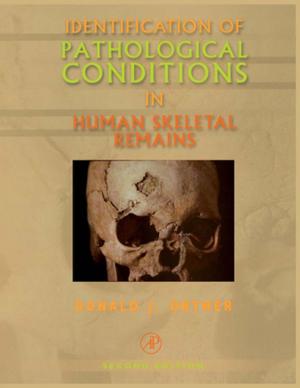 Cover of the book Identification of Pathological Conditions in Human Skeletal Remains by D. Miannay, P. Costa, D. François, A.B Vannes, A. Lasalmonie, D. Jeulin, D. Marquis, F. Vaillant, H. Burlet, J.C. Dupré, J.M. Georges, M. Bornert, M. Cherkaoui, R. Schirrer, T. Thomas, S. Pommier, A. Pineau