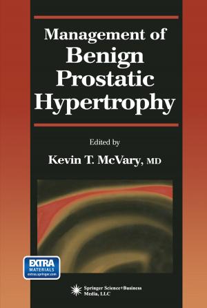 Cover of the book Management of Benign Prostatic Hypertrophy by Max Costa
