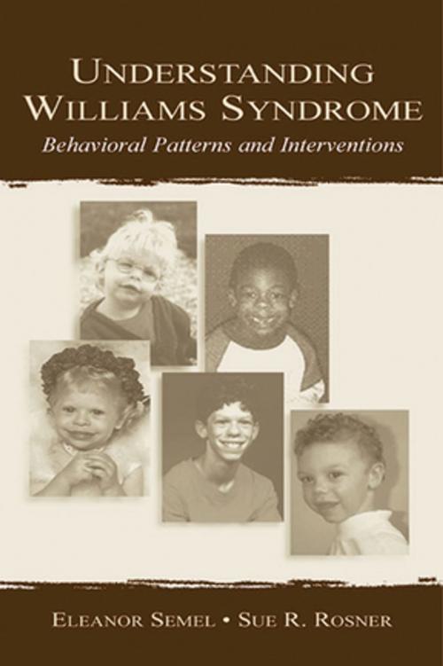 Cover of the book Understanding Williams Syndrome by Eleanor Semel, Sue R. Rosner, Taylor and Francis
