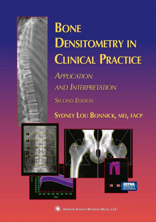Cover of the book Bone Densitometry in Clinical Practice by Sydney Lou Bonnick, Humana Press