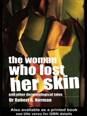 Cover of the book The Woman Who Lost Her Skin by Isa Baud, Ines Smyth