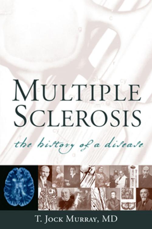 Cover of the book Multiple Sclerosis by Dr. T. Jock Murray, MS, Springer Publishing Company