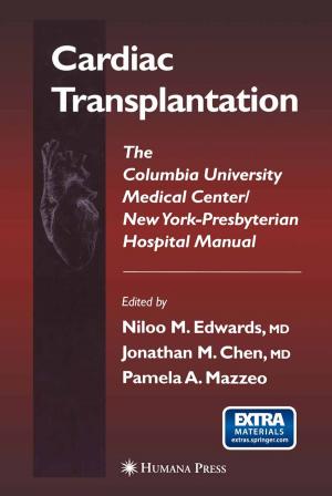 Cover of the book Cardiac Transplantation by Anthony Killeen