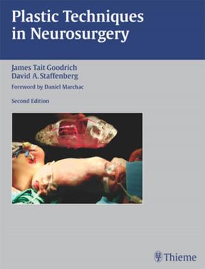 Cover of the book Plastic Techniques in Neurosurgery by Bradley Randleman, Iqbal Ike K Ahmed