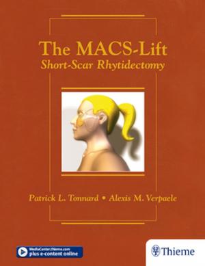 Cover of the book The MACS-Lift by Michael Schuenke, Erik Schulte, Udo Schumacher