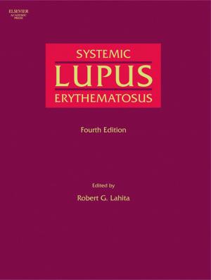 Cover of the book Systemic Lupus Erythematosus by Boualem Boashash
