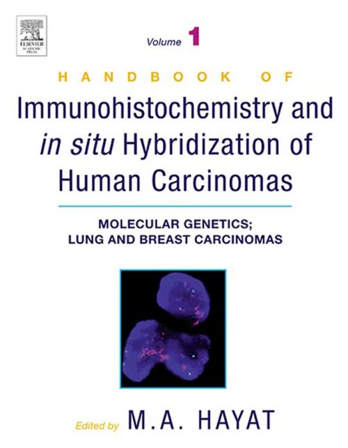 Cover of the book Handbook of Immunohistochemistry and in Situ Hybridization of Human Carcinomas by , Elsevier Science
