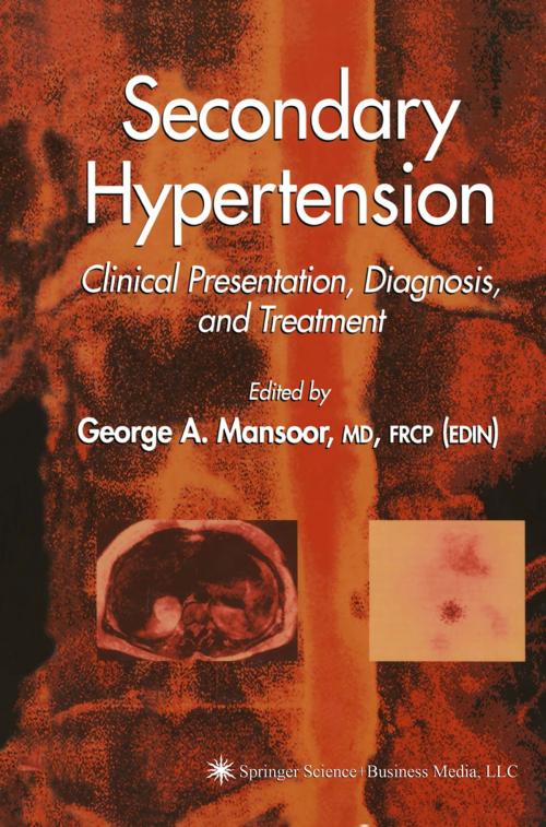 Cover of the book Secondary Hypertension by , Humana Press