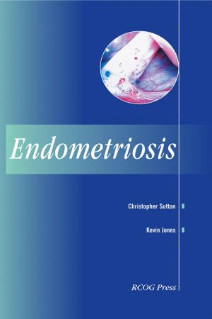 Book cover of Endometriosis