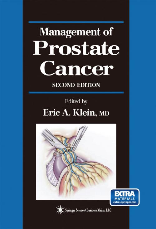 Cover of the book Management of Prostate Cancer by , Humana Press