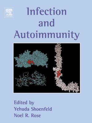 Cover of the book Infection and Autoimmunity by Tom Robl, Anne Oberlink, Rod Jones