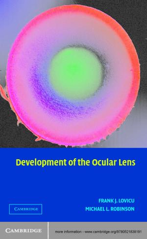 Cover of the book Development of the Ocular Lens by T. Y. Euliano, J. S. Gravenstein, N. Gravenstein, D. Gravenstein