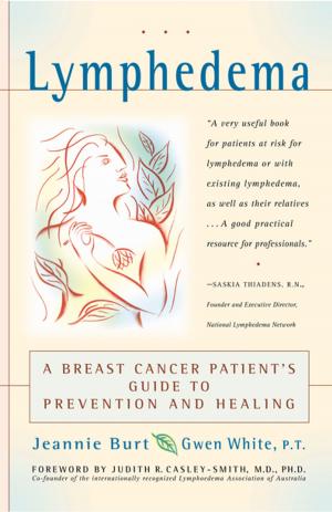 Cover of the book Lymphedema by James Robert Parish