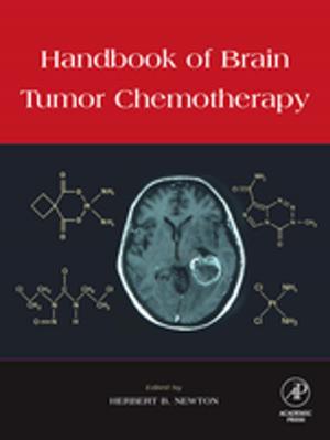 bigCover of the book Handbook of Brain Tumor Chemotherapy by 