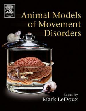 Cover of the book Movement Disorders by 