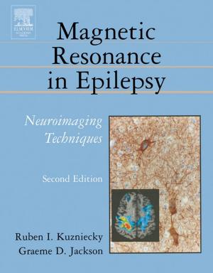 Cover of the book Magnetic Resonance in Epilepsy by Syngress, Dale Liu, Stephanie Miller, Mark Lucas, Abhishek Singh, Jennifer Davis