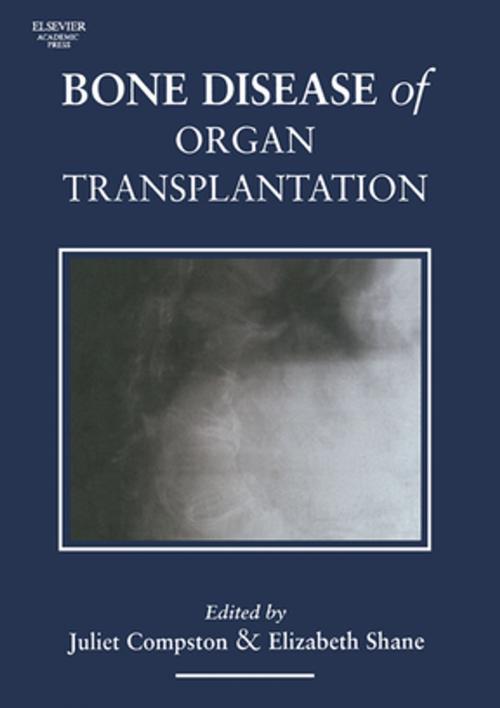 Cover of the book Bone Disease of Organ Transplantation by , Elsevier Science
