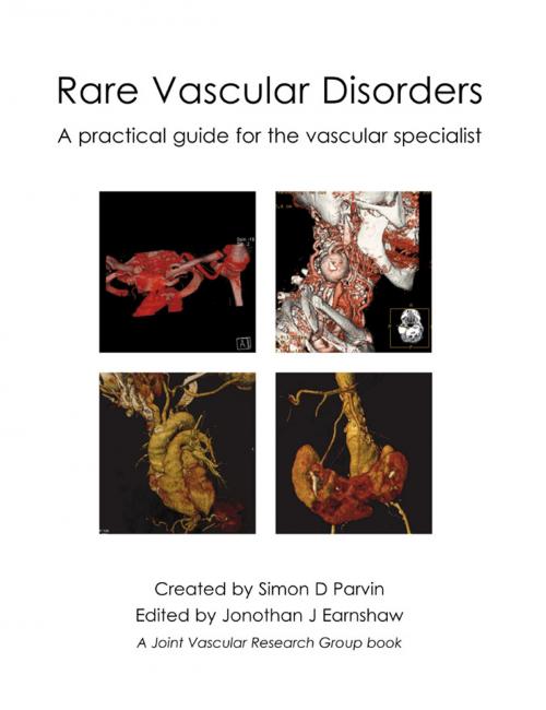 Cover of the book Rare Vascular Disorders by Simon D Parvin, Jonothan J Earnshaw, tfm Publishing Ltd