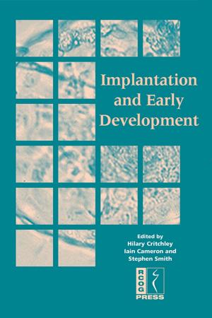 Cover of the book Implantation and Early Development by Anne Garden, Mary Hernon, Joanne Topping