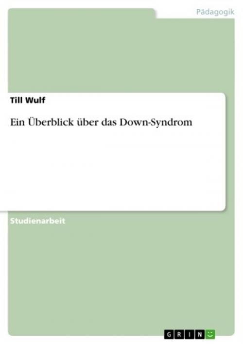Cover of the book Ein Überblick über das Down-Syndrom by Till Wulf, GRIN Verlag